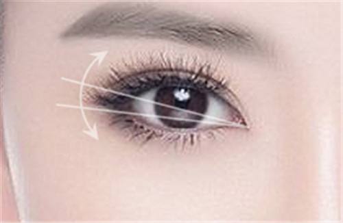 郭勇醫(yī)生的坐診地點及發(fā)際線種植案例，完美解決“禿頭少女”之困