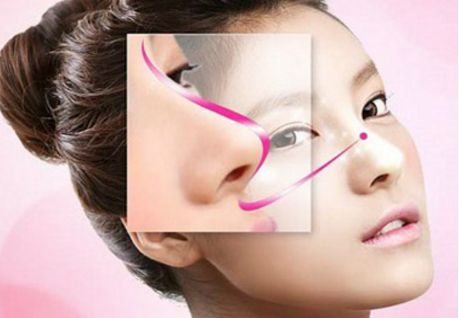 深圳駝峰鼻矯正哪家好？專業(yè)醫(yī)生推薦與真實案例分享！