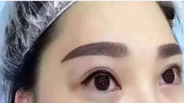 北京史三八整形醫(yī)院李珠賢紋眉口碑評價如何？