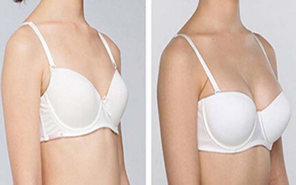 2023黑龍江3D精微祛眼袋在榜名單前10位專家(魯文起、尹又階、李麗麗個(gè)個(gè)醫(yī)生人氣高)