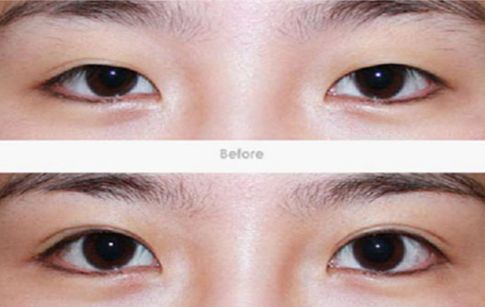 東莞哪家醫(yī)院的祛斑效果最好？一文揭秘東莞祛斑好醫(yī)院及其獨(dú)特療法