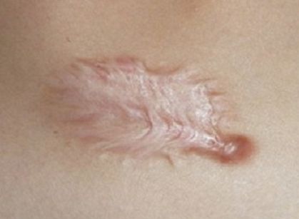 海南去雀斑哪家醫(yī)院好？探尋海南最受歡迎的雀斑祛除醫(yī)療機構