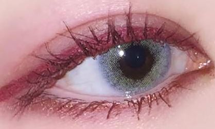 怎樣選擇合適的醫(yī)院和醫(yī)生進(jìn)行雙眼皮整形手術(shù)？