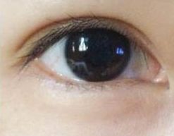 蘇州哪家祛痘醫(yī)院好？專家推薦的治療痘痘效果好的醫(yī)院