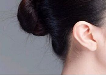 上海美萊做鼻綜合術(shù)如何手術(shù)價格和醫(yī)生評價如何？