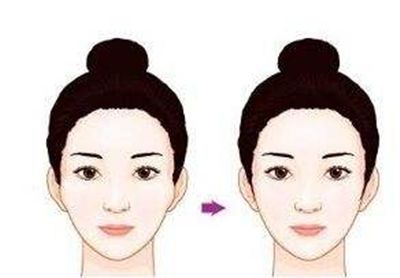 蘇州隆鼻手術費用及效果如何？