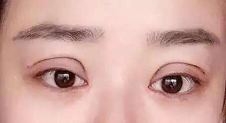 永州電波拉皮祛皺術醫(yī)生