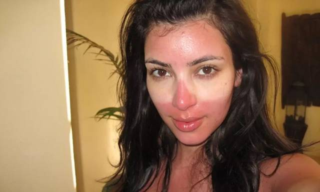 黑龍江注射去抬頭紋醫(yī)生