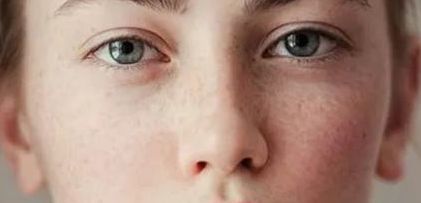 上海鼻小柱成形術(shù)整形醫(yī)院排名及手術(shù)費(fèi)用2025全新指南！