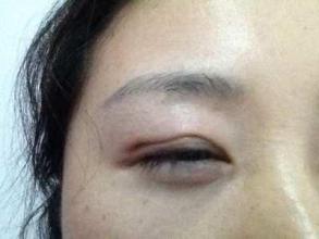 南京豐胸美容醫(yī)院2025年最新排行榜！