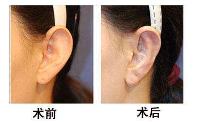 南京吸脂技術(shù)權(quán)威醫(yī)生排名前五公布！