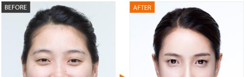 天津嘴角下垂改善醫(yī)院TOP榜：口碑實力全面解析！