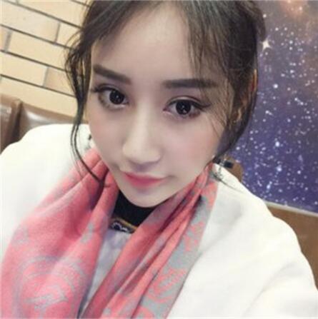 昆明麗都整形雙眼皮修復(fù)案例術(shù)后三個(gè)月