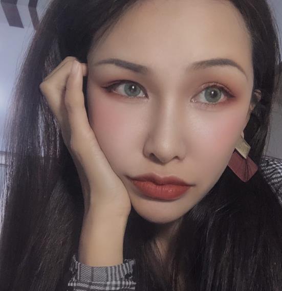 長春中研整形黃帝云鼻頭縮小案例術(shù)后三個月效果 長春中研整形黃帝云鼻頭縮小案例術(shù)后三個月效果