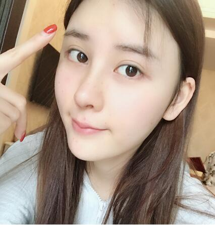 這么好的效果，不來蘭州美月做膨體隆鼻真是白瞎了醫(yī)生的技術(shù)