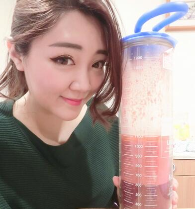 揭陽美萊整形手臂吸脂案例分享，輕松告別拜拜肉