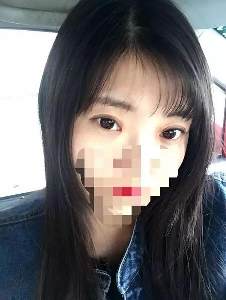 北京京民雙眼皮修復(fù)案例分享，說是媽生眼我都信