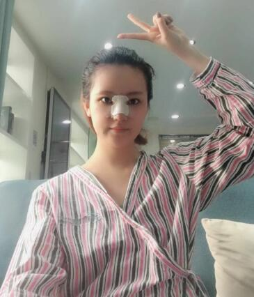 北京葉子整形肋軟骨隆鼻案例反饋，這鼻子是真實(shí)存在的嗎