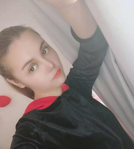 長沙雅美眼鼻整形案例分享，術(shù)后這滿滿的混血感是腫么回事