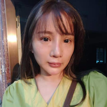 天津文怡整形水光針效果分享，化出來的好皮膚不如真的好皮膚