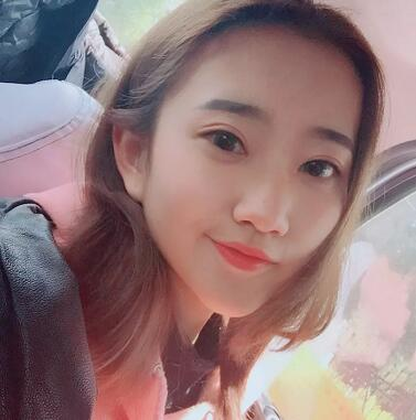 武漢藝星整形岳金堂醫(yī)生雙眼皮案例術(shù)后三個(gè)月效果反饋