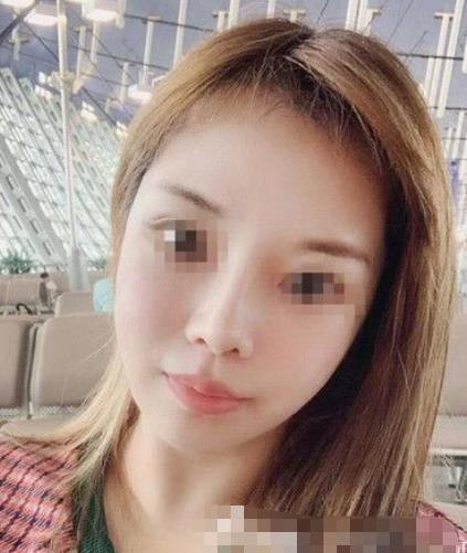 南京閱顏整形瘦臉針案例分享，輕松抗住原相機(jī)