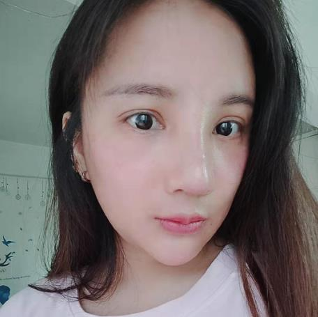 天津文怡整形水光針效果分享，化出來的好皮膚不如真的好皮膚