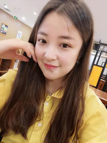 西安時(shí)光整形郭淑華雙眼皮案例分享，一個(gè)月就這么自然