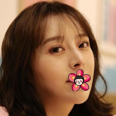 北京基礎(chǔ)美下頜角整形案例效果分享，黃大勇果然名不虛傳