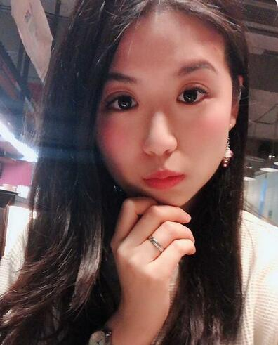 汕頭曙光整形皮秒激光祛斑一個(gè)月效果反饋，斑沒了