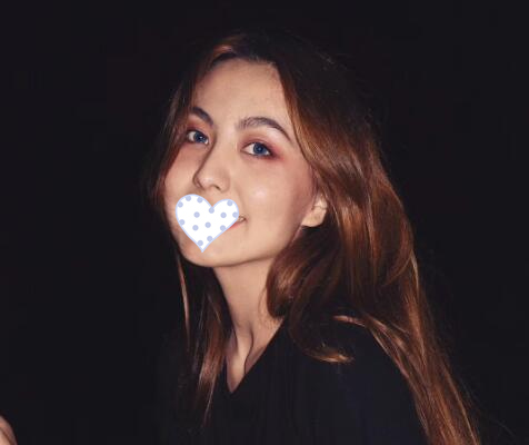 徐州時(shí)光洪揚(yáng)整形雙眼皮案例分享，好看到詞窮