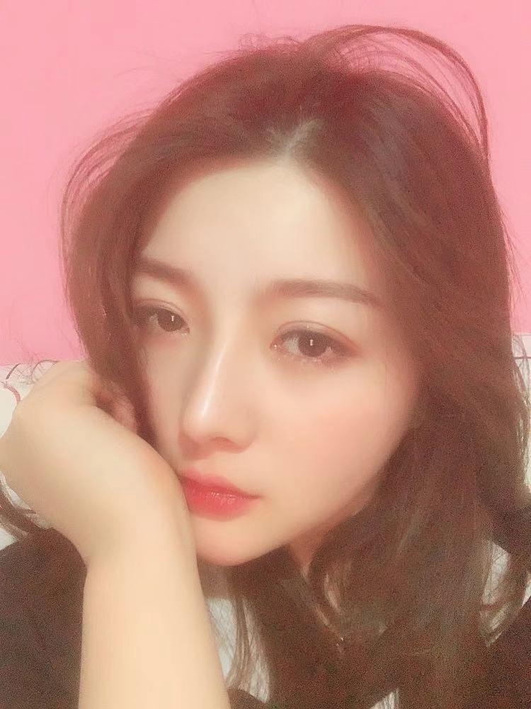 北京圣嘉榮二次鼻修復(fù)案例分享，做整形一定不要去莆田系醫(yī)院