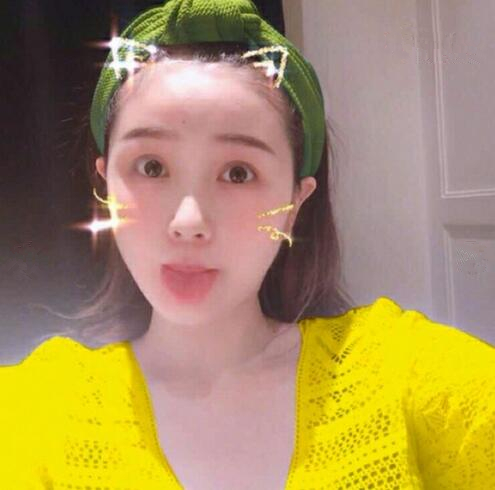 重慶美聯(lián)臣下頜角整形三個(gè)月效果 重慶美聯(lián)臣下頜角整形三個(gè)月效果