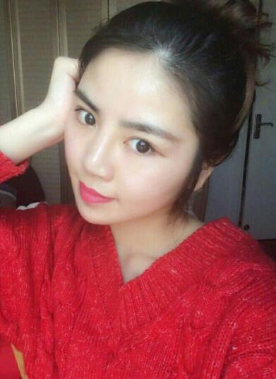 廣州中科美整形張金明下頜角整形案例分享