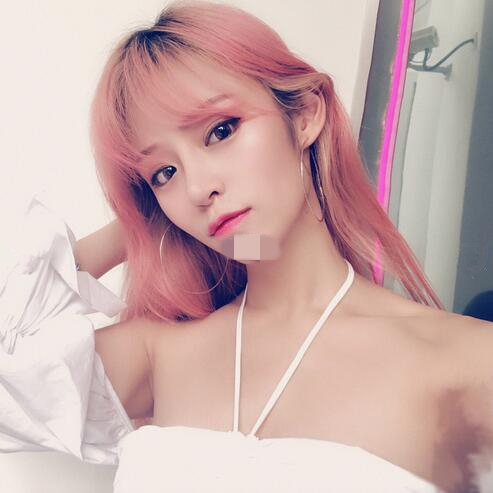 北京崔相平整形雙眼皮修復案例分享