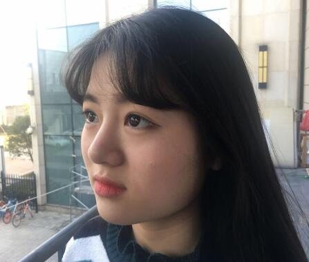 西安希美得整形瘦臉針瘦臉半個(gè)月效果反饋