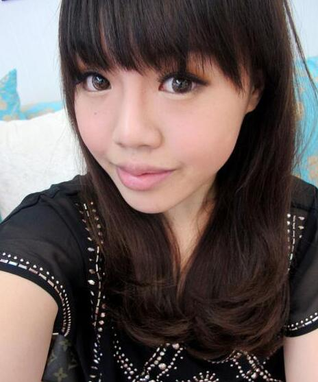 杭州藝涵整形玻尿酸豐唇一周效果分享