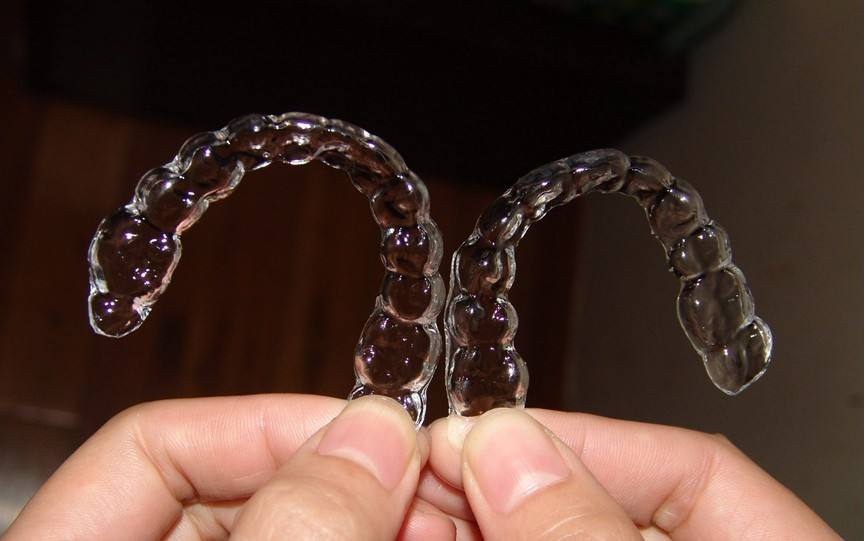 自貢華醫(yī)口腔金屬托槽矯正案例分享