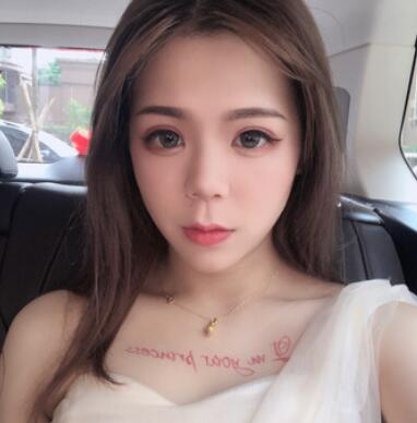 長(zhǎng)沙梵童王志軍自體脂肪填充案例效果對(duì)比