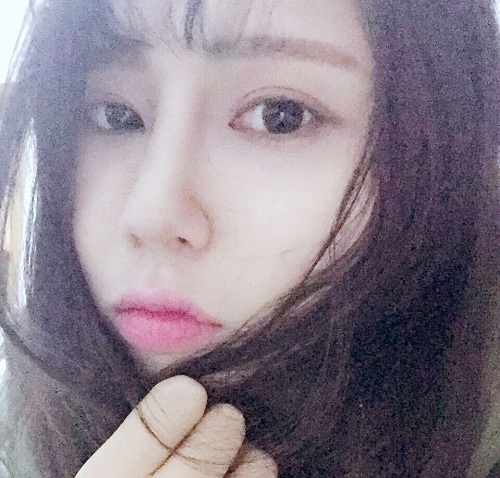 做完鼻骨縮窄手術完全恢復的樣子 做完鼻骨縮窄手術完全恢復的樣子