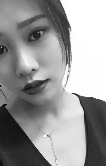 上海伊美爾港華整形醫(yī)生師麗麗做雙眼皮怎么樣？師麗麗雙眼皮案例分享