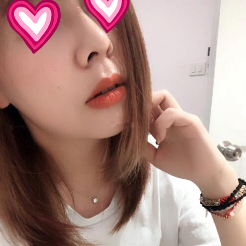 西安儷人醫(yī)院整形醫(yī)生蘇鵬做隆鼻技術(shù)怎么樣？附蘇鵬醫(yī)生隆鼻案例