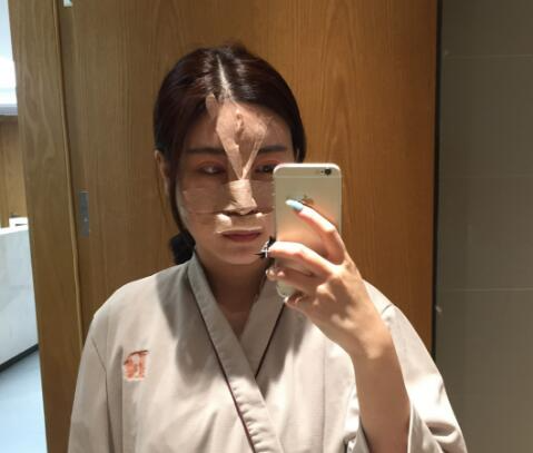 北京彤美整形醫(yī)院專家李長賦做鼻部綜合整形怎么樣？