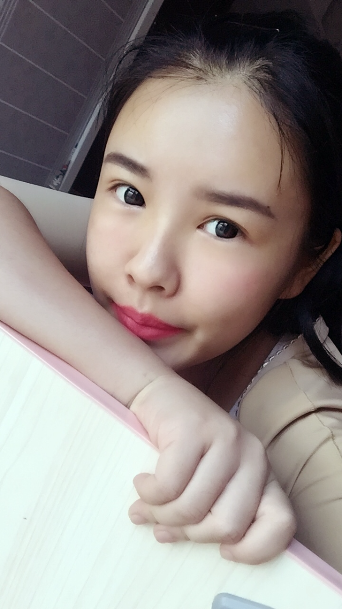 西安莎曼妃醫(yī)療美容醫(yī)院醫(yī)生樸俊做自體脂肪豐太陽(yáng)穴效果怎么樣？