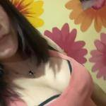 南寧伊美整形醫(yī)生凌宏量做自體脂肪隆胸怎么樣？自體脂肪隆胸案例