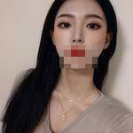 術(shù)后照片 術(shù)后照片