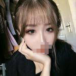 濟(jì)南鵬愛(ài)整形醫(yī)生楊力做顴骨顴弓整形技術(shù)怎么樣？楊力醫(yī)生案例展示