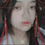 上海亞太醫(yī)療專家周聰做雙眼皮怎么樣？附周聰醫(yī)生雙眼皮案例