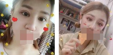 做了全切雙眼皮不僅外表變美了，內(nèi)心也更加自信了