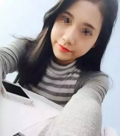 做完膨體隆鼻，鼻子變“挺”了